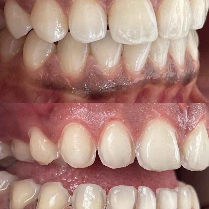 close up of teeth Periodontics