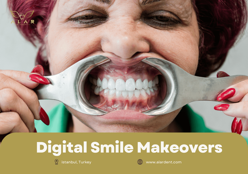 digital smile design